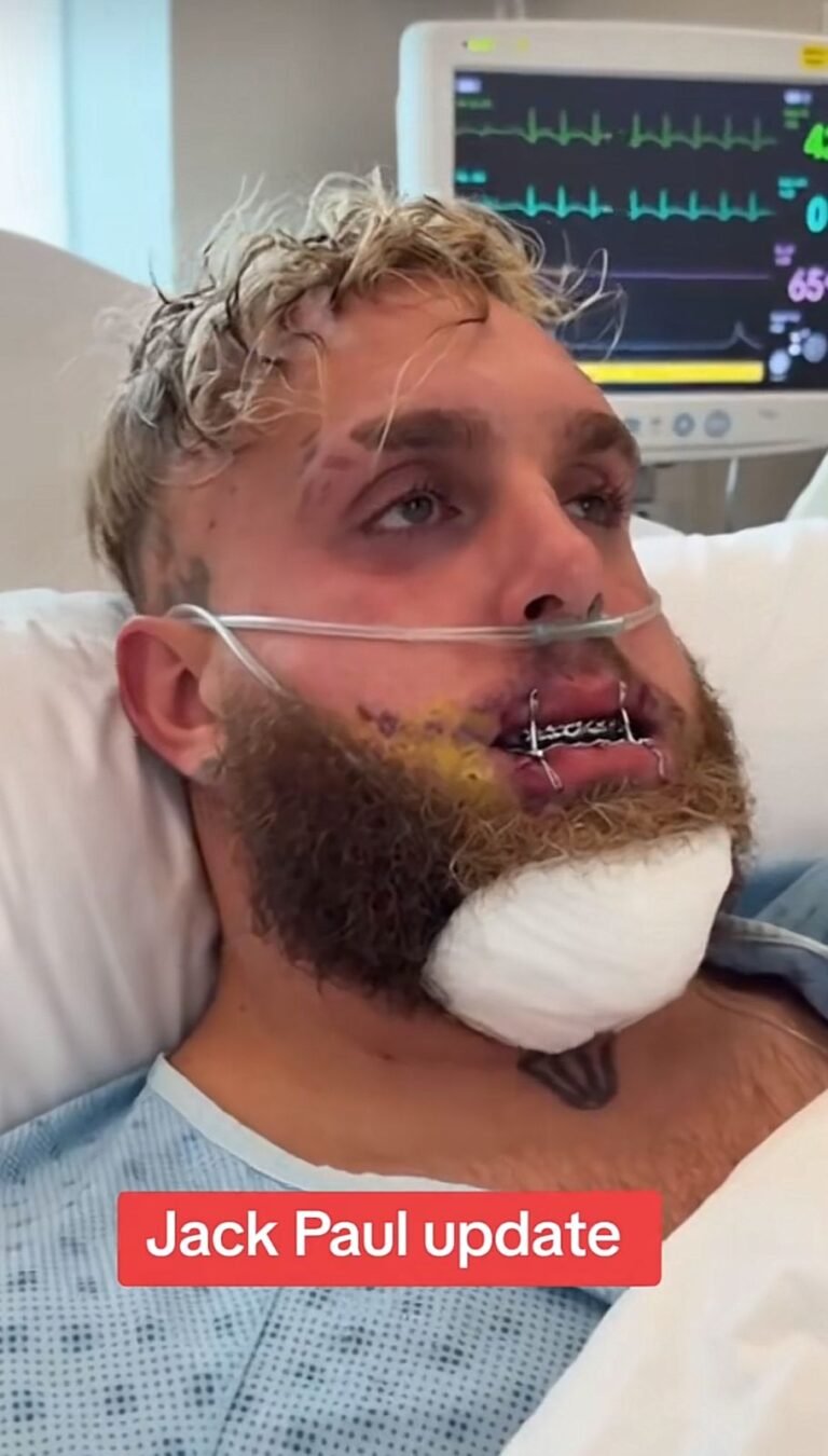 Jake Paul setelah bertarung dengan Anthony Josua. (Foto: Google).